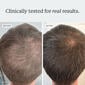 Densifying Scalp Serum thumbnail